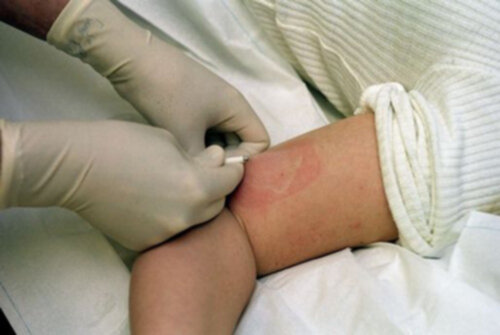 vilket preventivmedel är bäst vilket preventivmedel är bäst