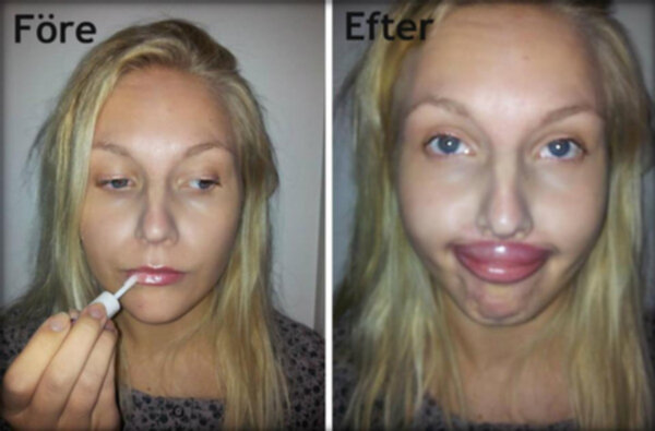 lip plumper bäst i test 2016 lip plumper bäst i test 2016